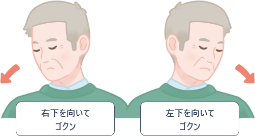 横向き嚥下法。嚥下機能の悪い側に頸部を回旋して嚥下する。