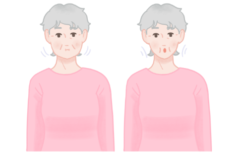 嚥下体操5、頬を膨らませたり引っ込めたりする。2〜3回繰り返す。