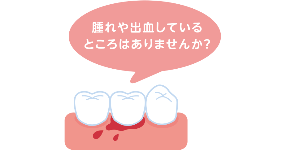 腫れや出血しているところはありませんか？